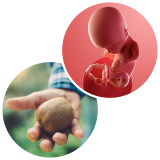 Composite. One side shows a foetus attached to the placenta by the umbilical cord. The foetus is recognisable as a baby. Other side shows a person holding a kiwi fruit in one hand.