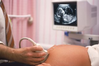 A healthcare professional holding a scanner on the tummy of a pregnant woman with white skin. An ultrasound image of a baby is visible on a screen.