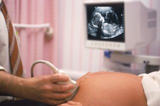 A sonographer holding a scanner on a pregnant persons stomach