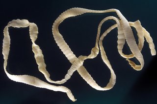 A flat, pale yellow tapeworm is lying in loops on a dark background. The body of the tapeworm is made up of narrow ridged sections.