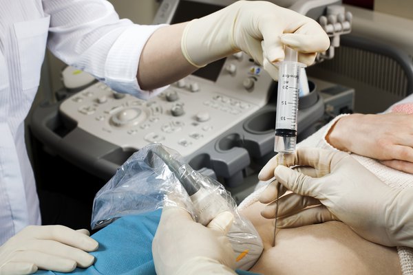 Picture of a woman having CVS