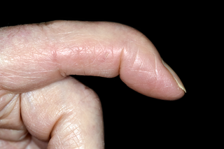 A finger pointing from left to right, with the tip of the finger bending downwards.