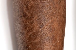 A close-up showing thickened and dry skin with ichthyosis scaling on brown skin.