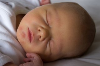Newborn baby's face with white skin. The skin looks yellow because of jaundice.