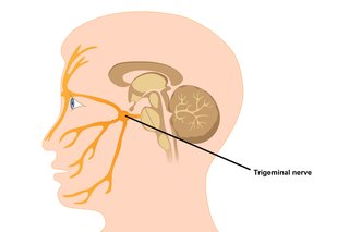 A medical diagram of the trigeminal nerve showing how it runs from the side of the skull, close to the ear, to the front of the face