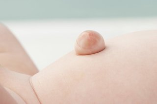 Close-up of a baby's tummy, showing a lump of shiny-looking skin sticking out from the belly button. The hernia is approximately 1cm across.