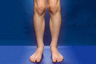 A person's knees, lower legs and feet. The knees are touching and there is a gap of around 10cm between the ankles.