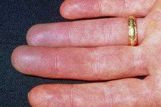 Fingers of a person with white skin, with red or dark pink fingertips, while the rest of the skin is lighter pink and white.