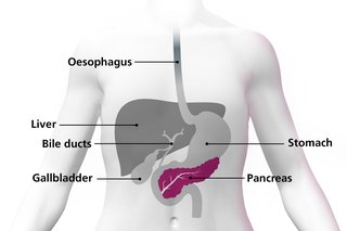 Diagram of a body highlighting the pancreas as an organ under the stomach.