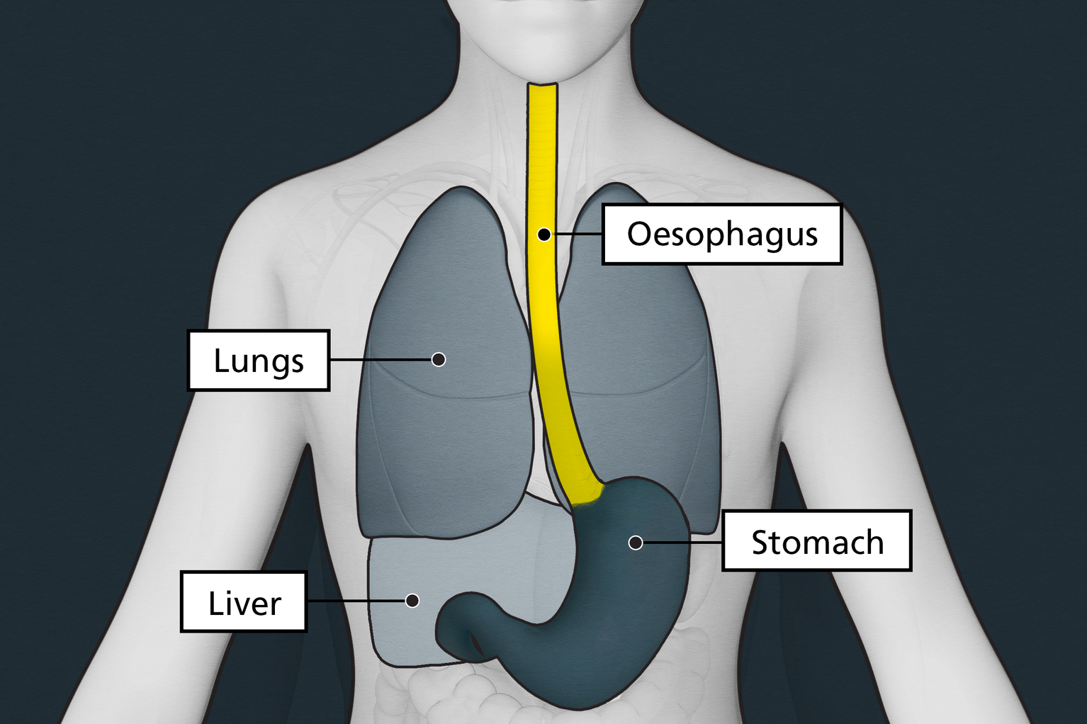 research article on oesophageal cancer