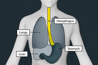 Diagram of the upper part of the body with the oesophagus highlighted in yellow and shown as a tube that runs from the mouth to the stomach.