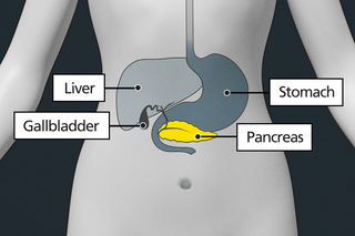 Diagram of the stomach area with labels showing the liver, stomach, gallbladder and pancreas. The pancreas is highlighted to show it can be affected by pancreatic cancer.
