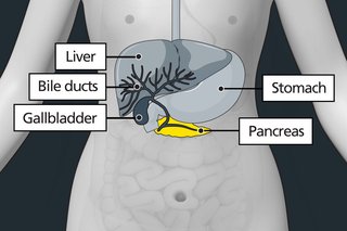 Diagram of the stomach area with labels showing the liver, stomach, gallbladder and pancreas. The pancreas is highlighted to show it can be affected by pancreatic cancer.