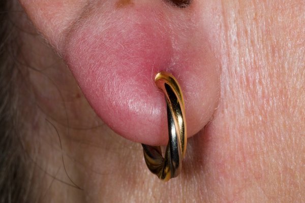 It's easy for piercings to become infected