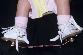 Close-up of a baby’s feet. The baby is wearing a pair of white boots that are attached to a bar.