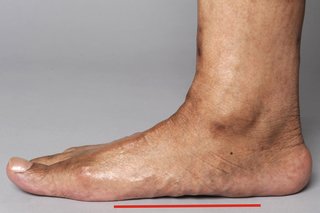 A man's right foot placed flat on the ground. There is no gap between the foot and the ground.