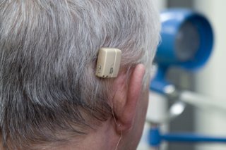 A small, square, plastic bone anchored hearing aid attached just above and behind the ear.
