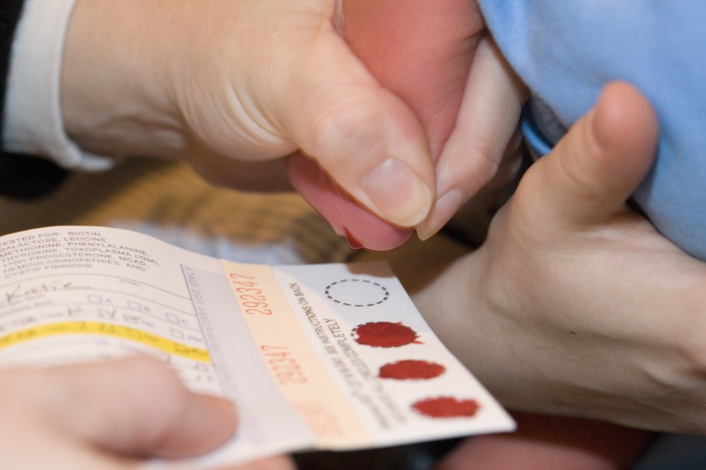 Newborn Screening For Sickle Cell Disease In Europe