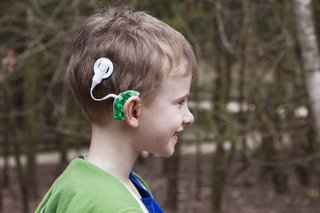 A round, plastic cochlear implant device attached to the side of the head, connected to a microphone worn behind their ear.