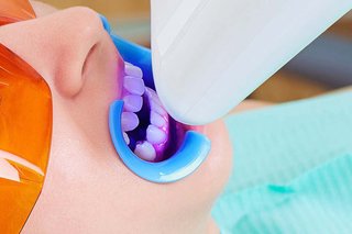 Close-up of a person wearing protective glasses and a mouthguard. A device is shining a purple light onto their teeth.