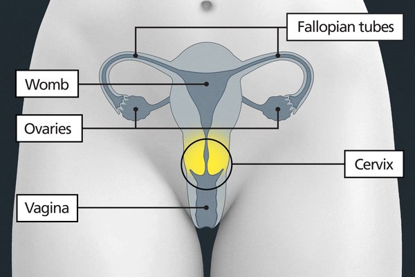 Diagram of the pelvic area with labels showing the vagina, cervix, womb, fallopian tubes and ovaries.  The cervix is above the vagina.