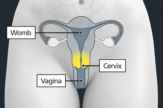 Diagram of the body highlighting the cervix as the opening between the vagina and the womb.