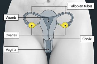 Diagram of the pelvic area with labels showing the cervix, womb, fallopian tubes and 2 ovaries.  The ovaries are either side of the womb.