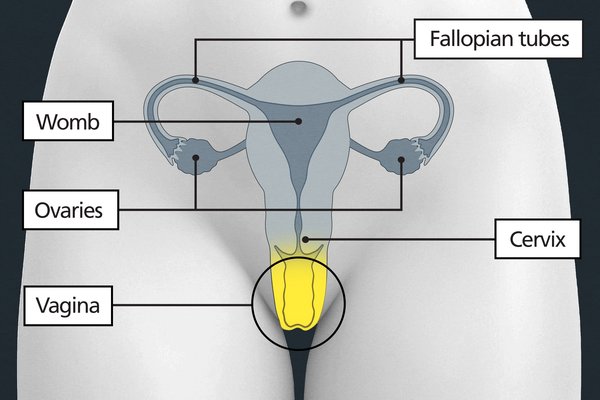 Diagram of the pelvic area with labels showing the vagina, cervix, womb, fallopian tubes and ovaries. The vagina is below the womb and cervix.