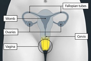 Diagram of the pelvic area with labels showing the vagina, cervix, womb, fallopian tubes and ovaries. The vagina is below the womb and cervix.