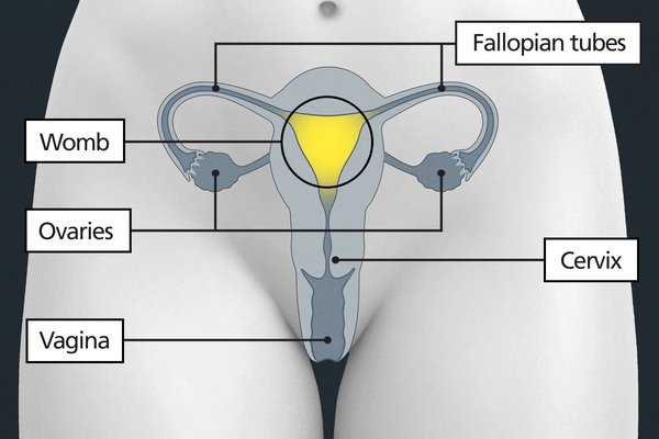 Diagram of the pelvic area with labels showing the vagina, cervix, womb, fallopian tubes and ovaries. The womb is above the vagina and cervix.