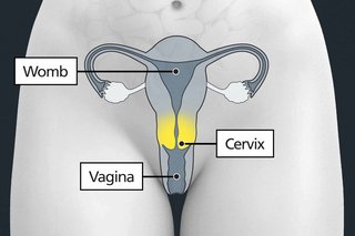 Diagram of the body highlighting the cervix as the opening between the vagina and the womb.