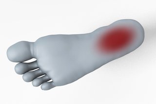 The bottom of a foot with some red shading at the back of the foot, towards the heel, showing where the pain of plantar fasciitis is felt.