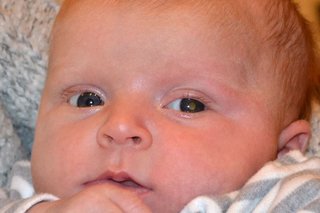 Close-up of a baby's face showing a white reflection in the middle of their left eye.