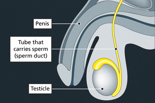 A diagram showing a side-on view of the penis and testicles and the tube that carries sperm from the testicles (sperm duct).