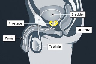 Diagram showing where the prostate gland is, under the bladder and behind the penis.