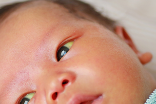 Newborn baby's face with white skin. The whites of the eyes look yellow because of jaundice.