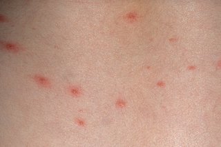 Small red spots on white skin