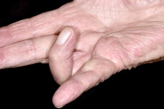 Tangan kanan berwarna putih teracung datar dengan jari manis ditekuk ke arah telapak tangan