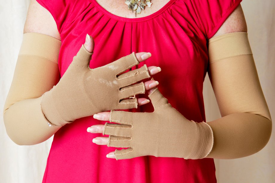 Picture of compression bandages for lymphoedema