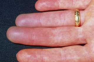 Red fingers caused by Raynaud's