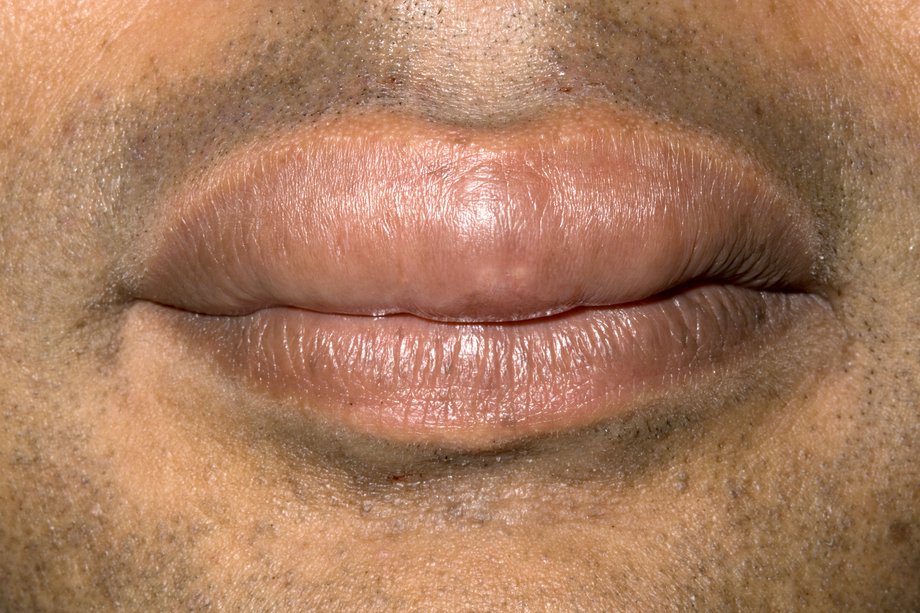 lips skin problems