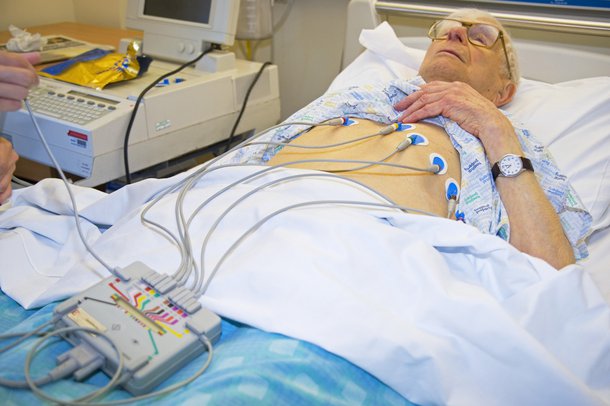 test heart is called Electrocardiogram (ECG) NHS.UK test heart is called Electrocardiogram (ECG) NHS.UK