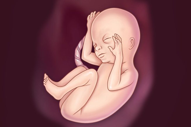 Foetus at 17-20 weeks