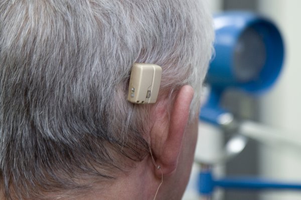 Picture of bone anchored hearing aid. Image Credit: LIFE IN VIEW/SCIENCE PHOTO LIBRARY