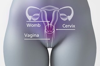 The cervix is between the vagina and the womb